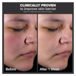 Paulas Choice--SKIN PERFECTING