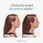 Nutrafol Women's Balance Hair